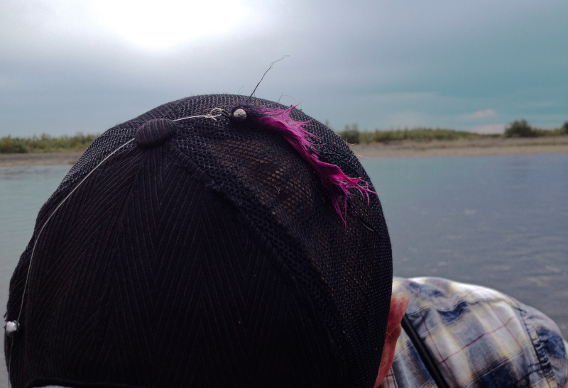 Removing a Fish Hook How to Safely Remove a Fish Hook From Your Skin